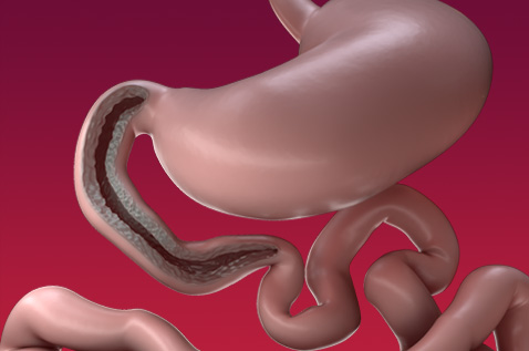 Duodenum
